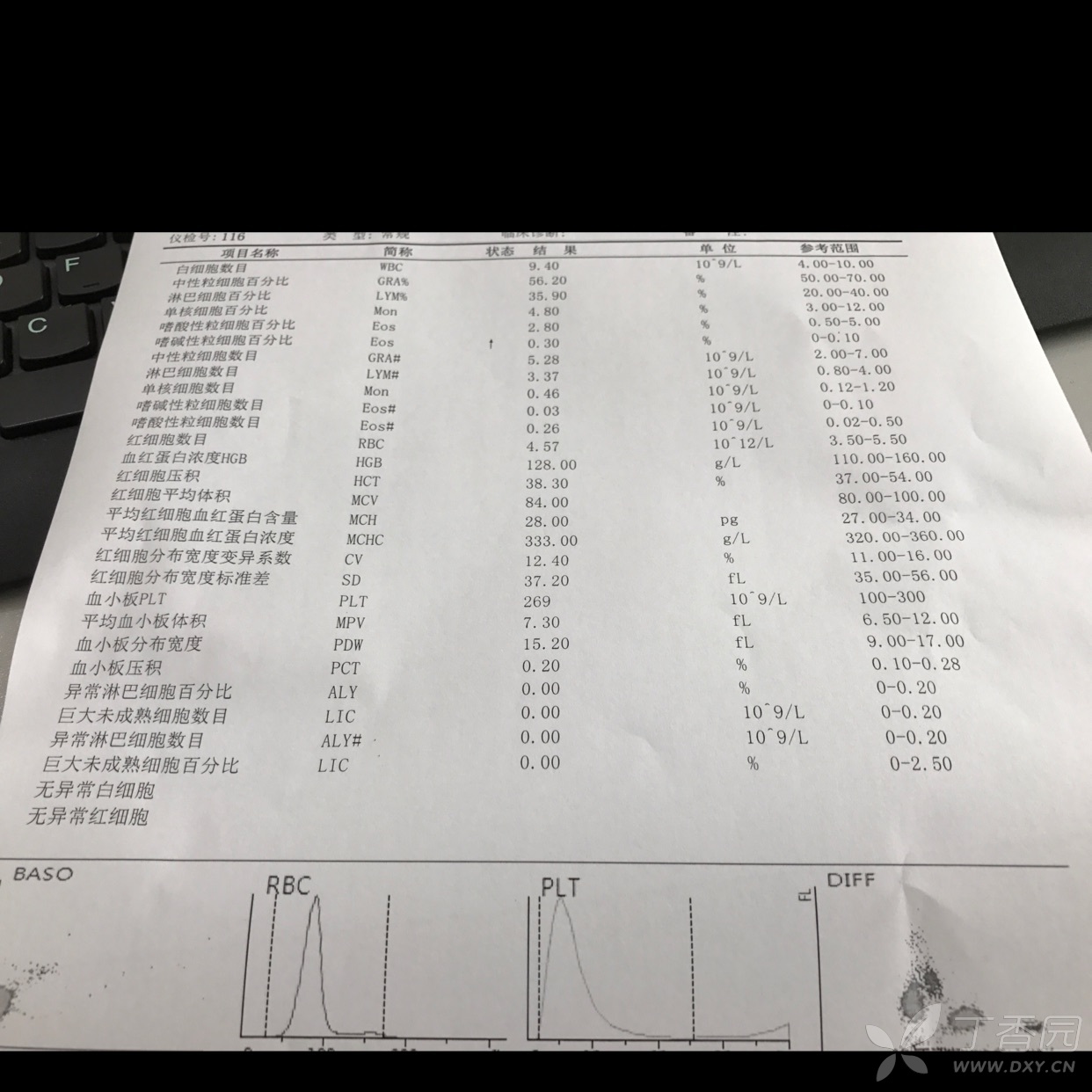 孤独的小住院医  血常规未见异常,这像不像过敏性紫癜?