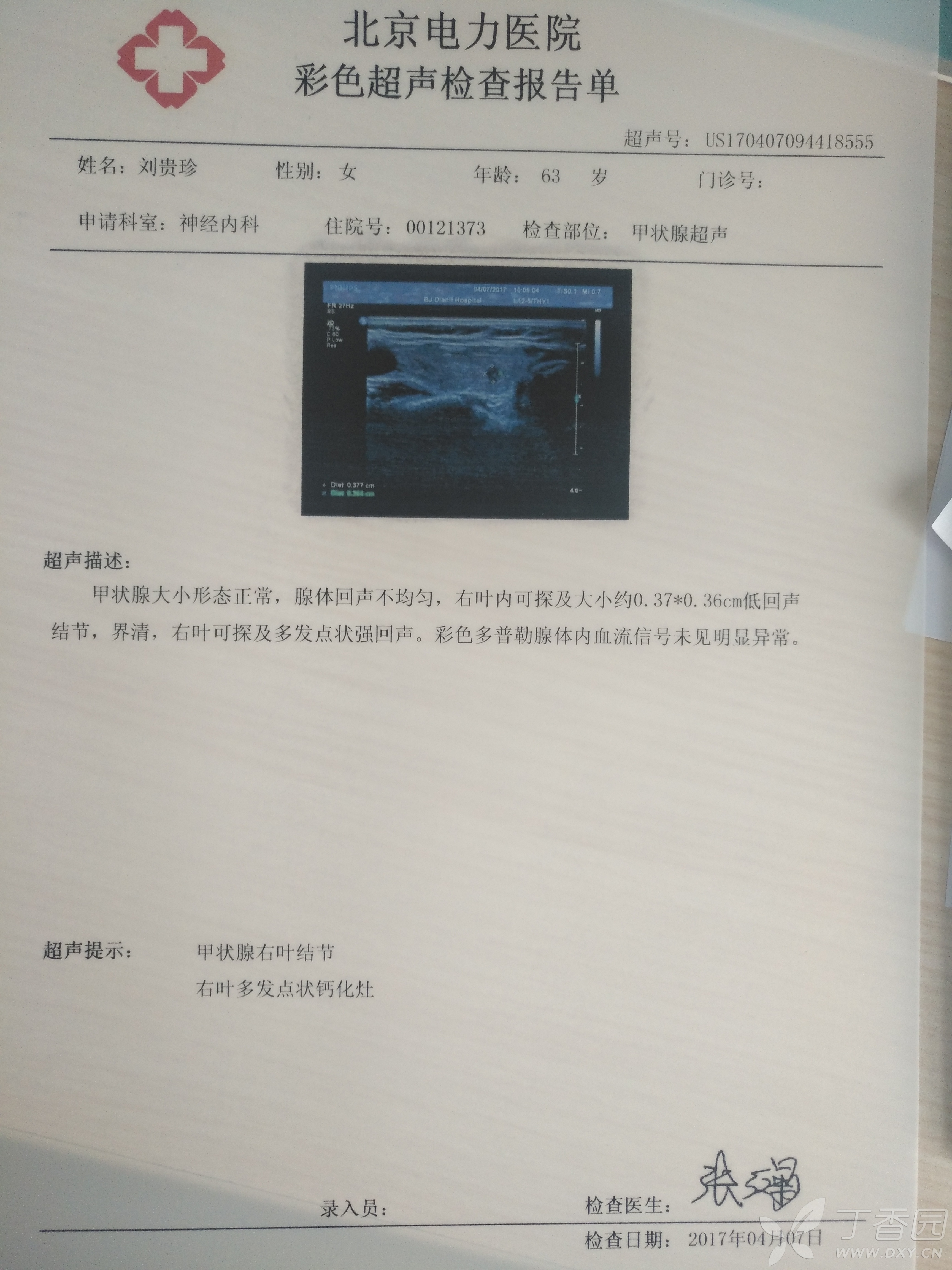 乳腺癌甲状腺癌患者