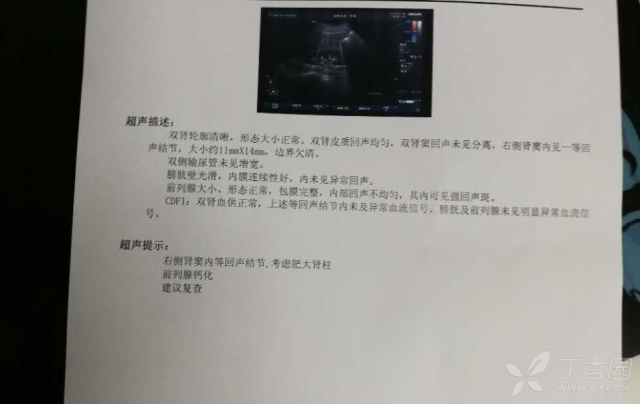 肾柱是低回声而且边界清晰,想请教一下是否几个月后复查彩超或者直接