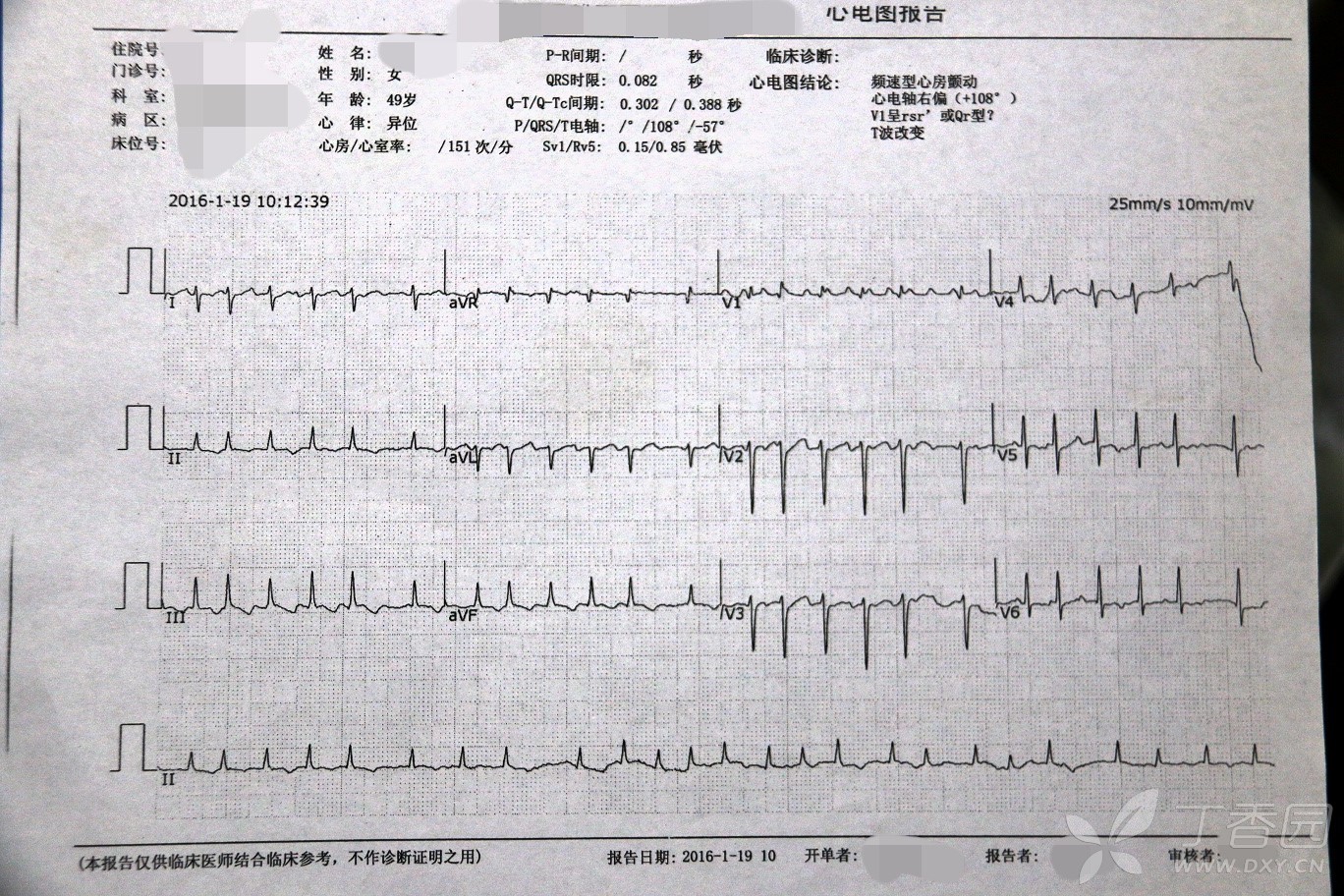 上传一例心脏骤停病例,请各位老师帮忙分析原因 - 心