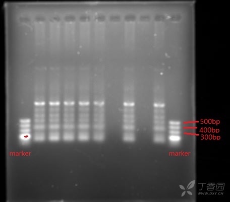 最左边和最右孔为marker(500bp),中间7孔上样孔,加的是同一pcr产物