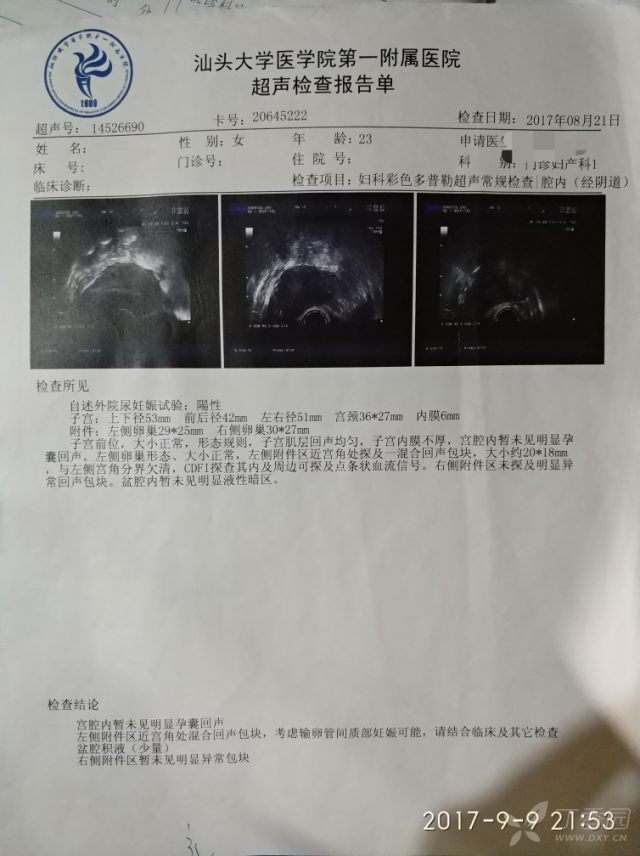 求问宫外孕保守治疗后包块处理