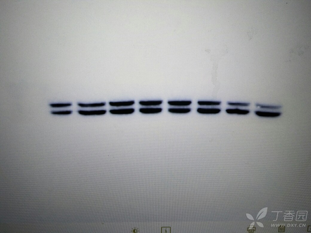 求教wb的条带问题,请前辈们指点一下