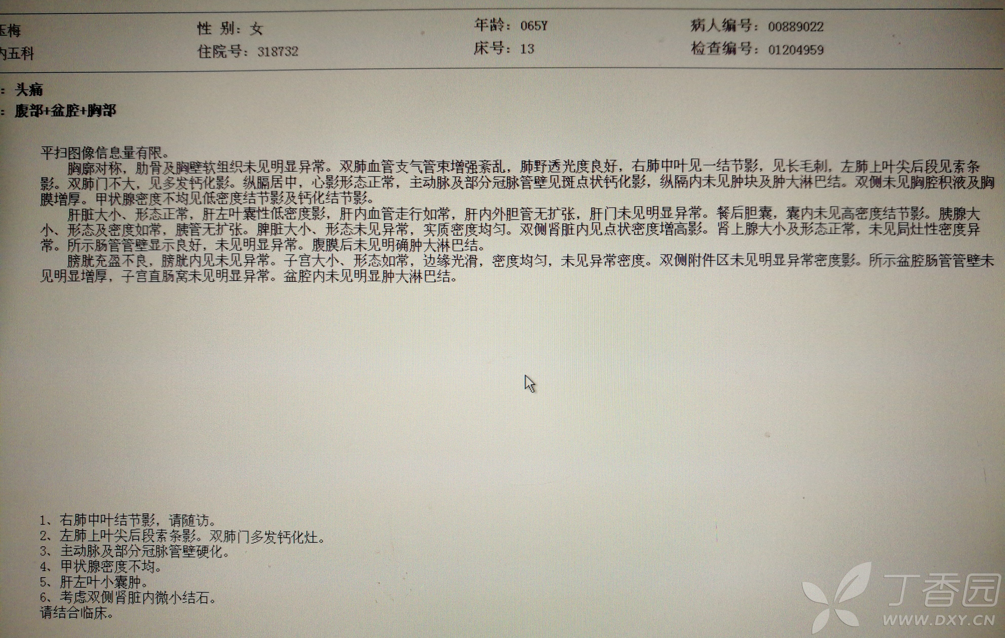 胸椎椎体及附件病变,请各位同道分析. [病例帖]