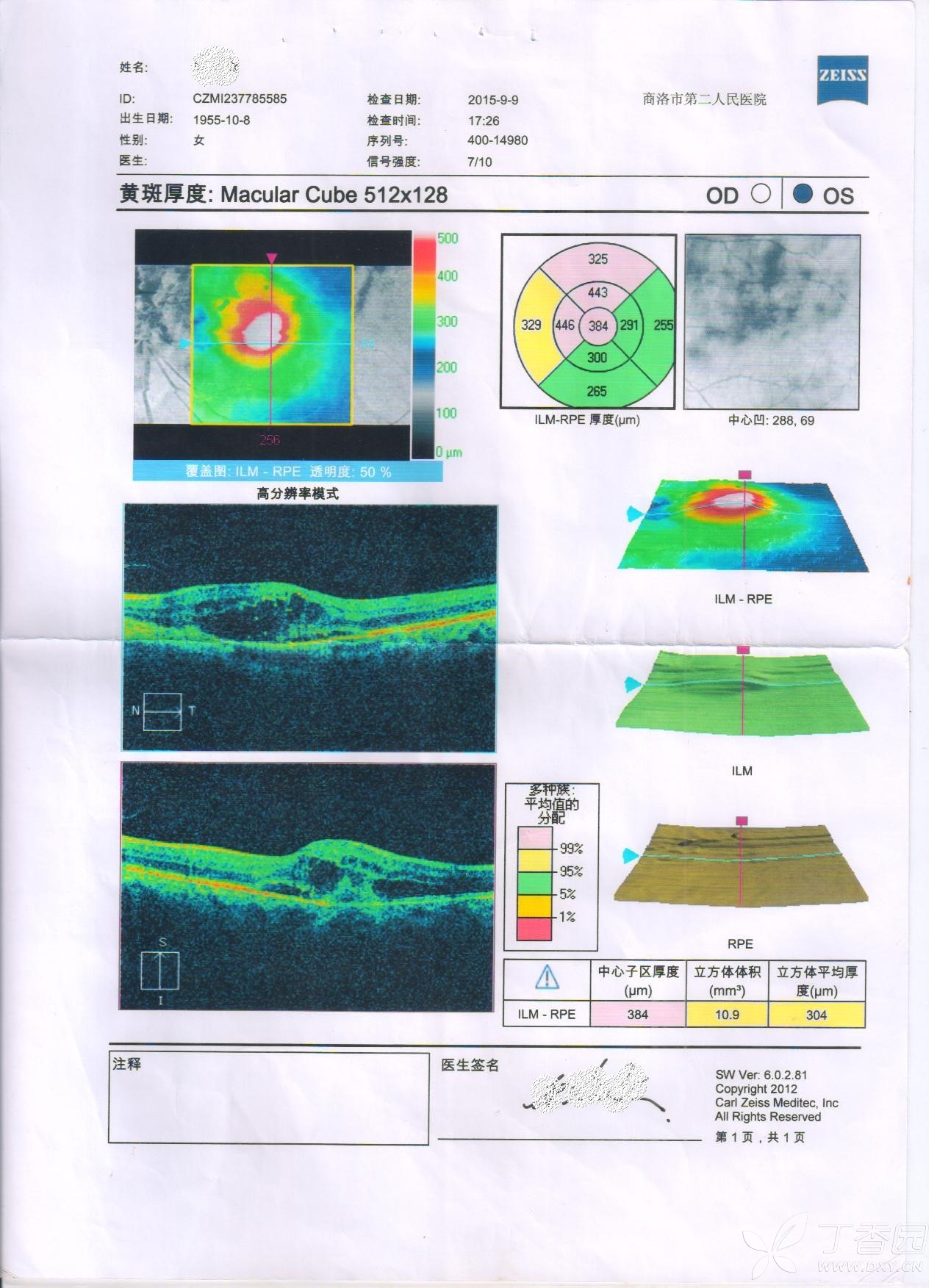 湿性年龄相关性黄斑变性 黄斑水肿 黄斑漆裂纹 还有哪些治疗方法?