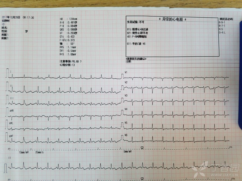 心电图求诊断 [病例帖]