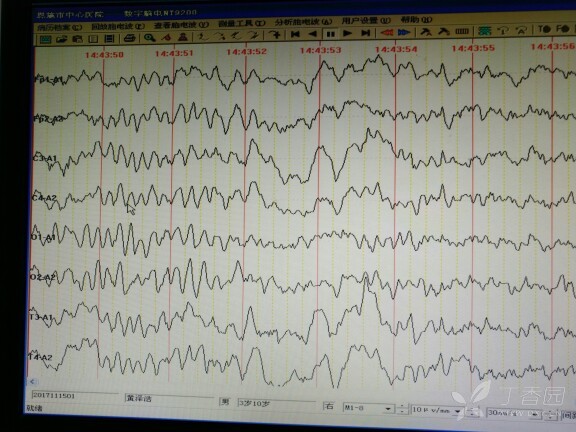 大家帮忙分析小儿脑电图
