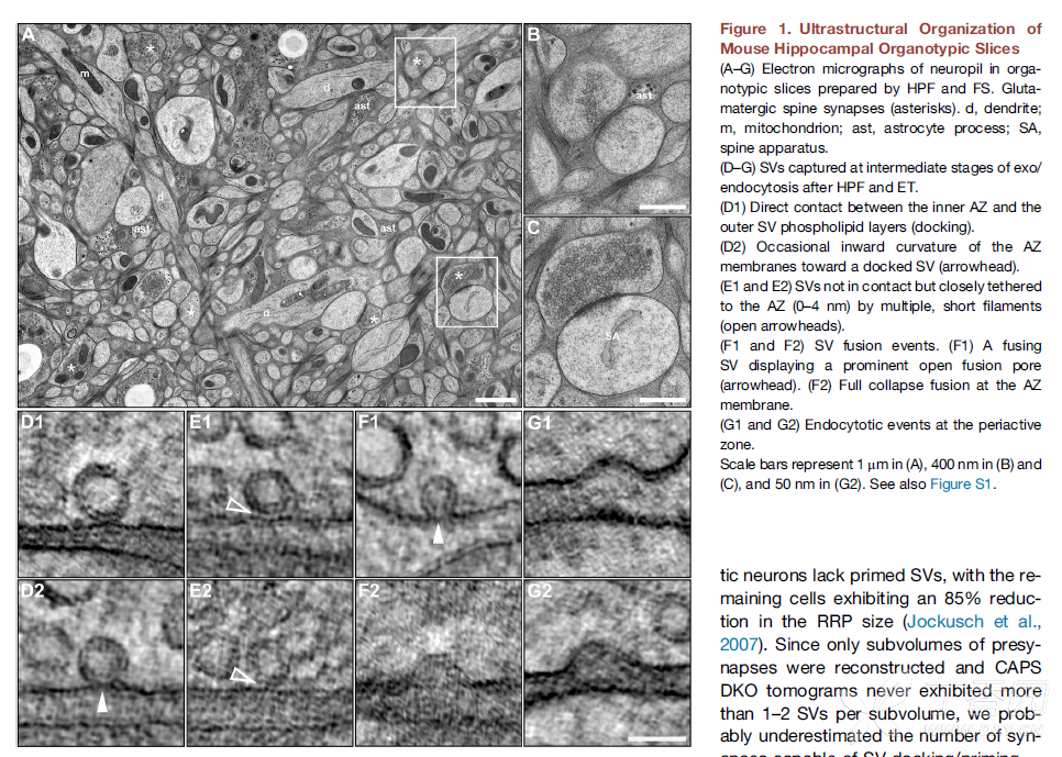 for measure psd, synaptic cleft, active zone, number of