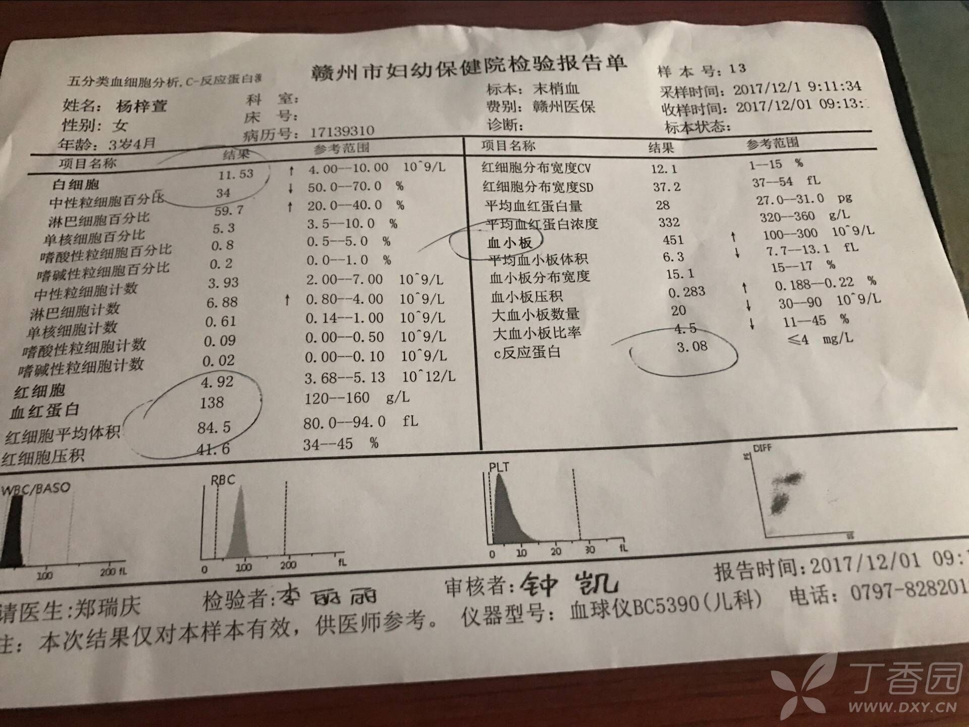 两个女儿咳嗽一个多月了,突然发烧,带去医院化验血,白
