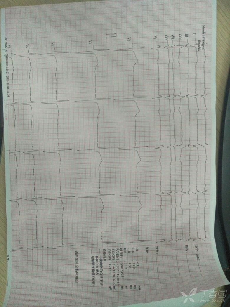 关注      点赞 收藏 全部讨论(2) 12-06 20:08 这个心电图的走纸