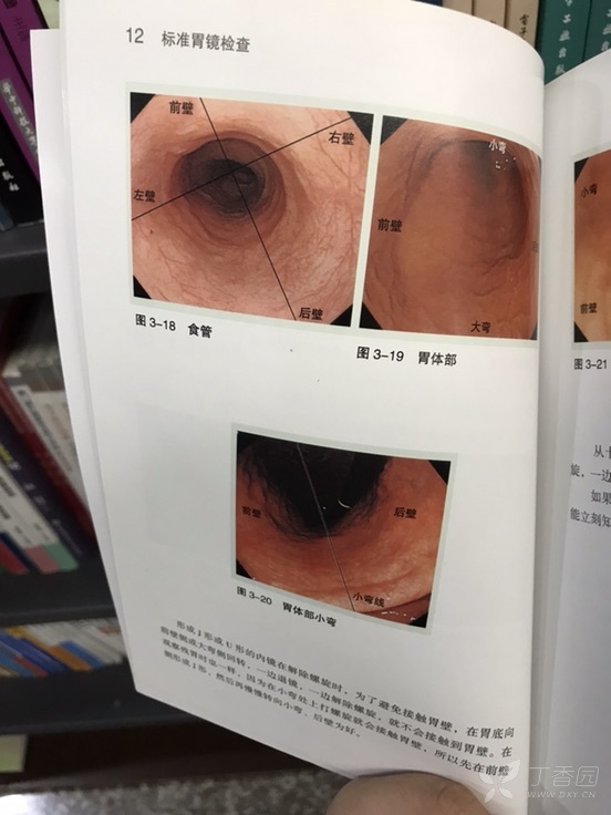 食管四壁是这样划分的