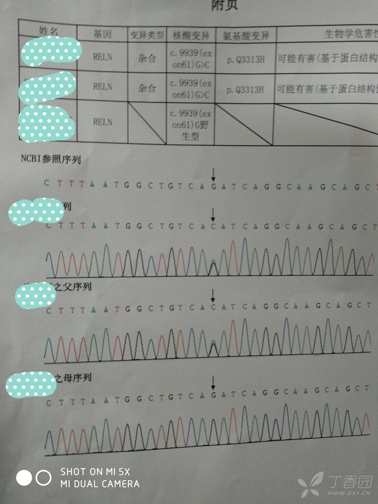 一岁1个月宝宝一天3次抽风,脑电图正常 做了基因检测