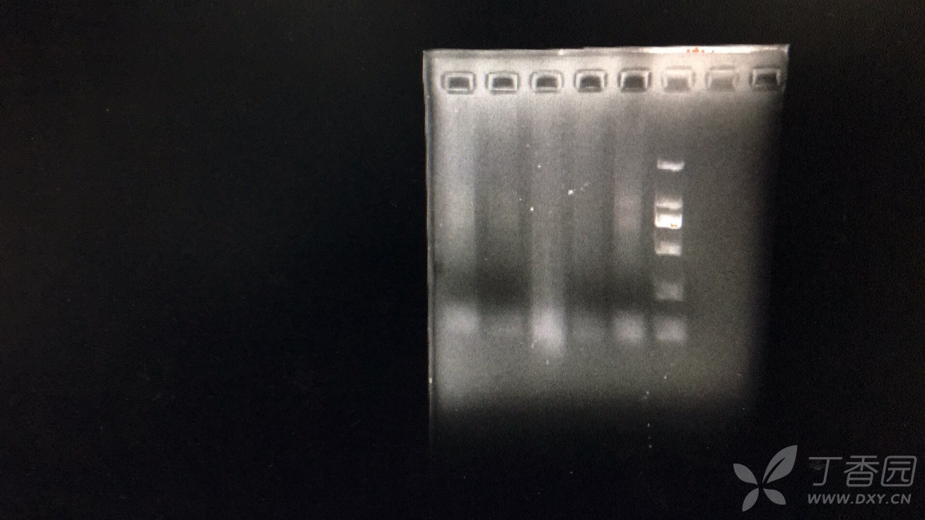 trizol提取rna,跑胶结果很差