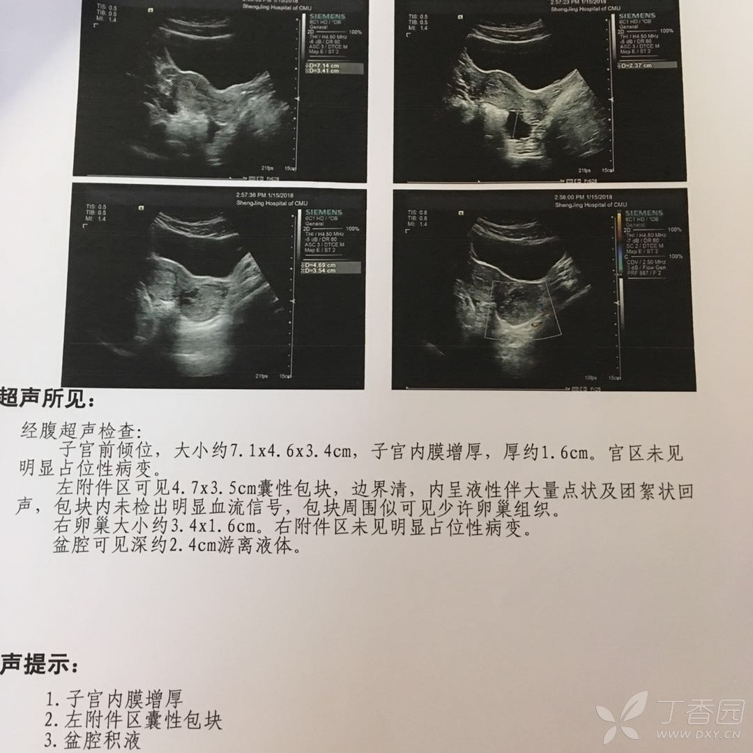 在线制作假的怀孕b超单 - 超逼真的装逼神器 - 自制怀孕B超检查单