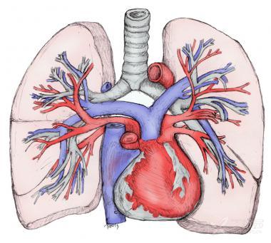 从入门到精通:ct 能看出的 10 种「肺动脉病变」