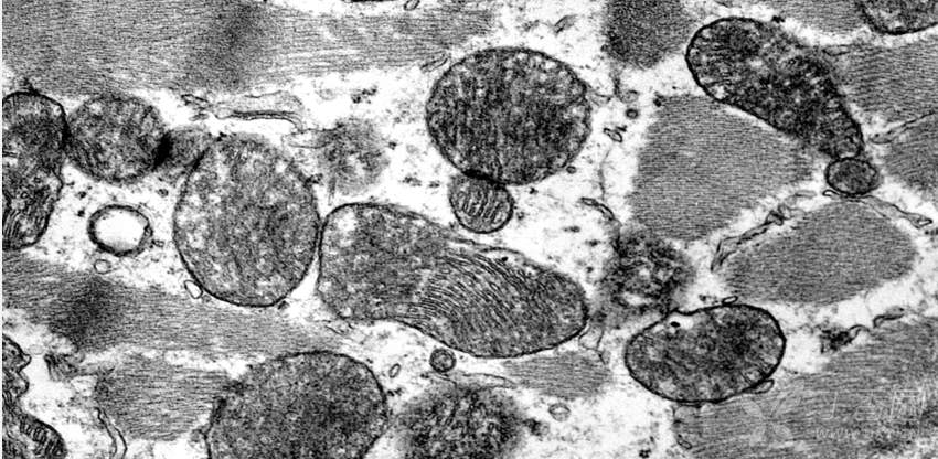 心肌透射电镜图片请教