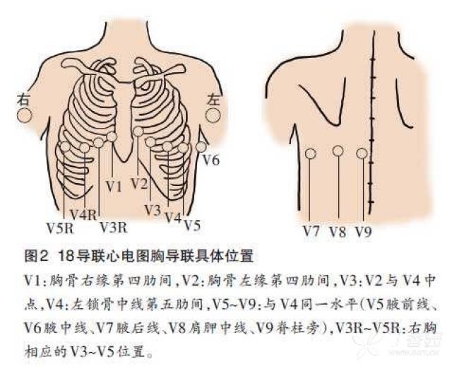 全导心电图怎么做