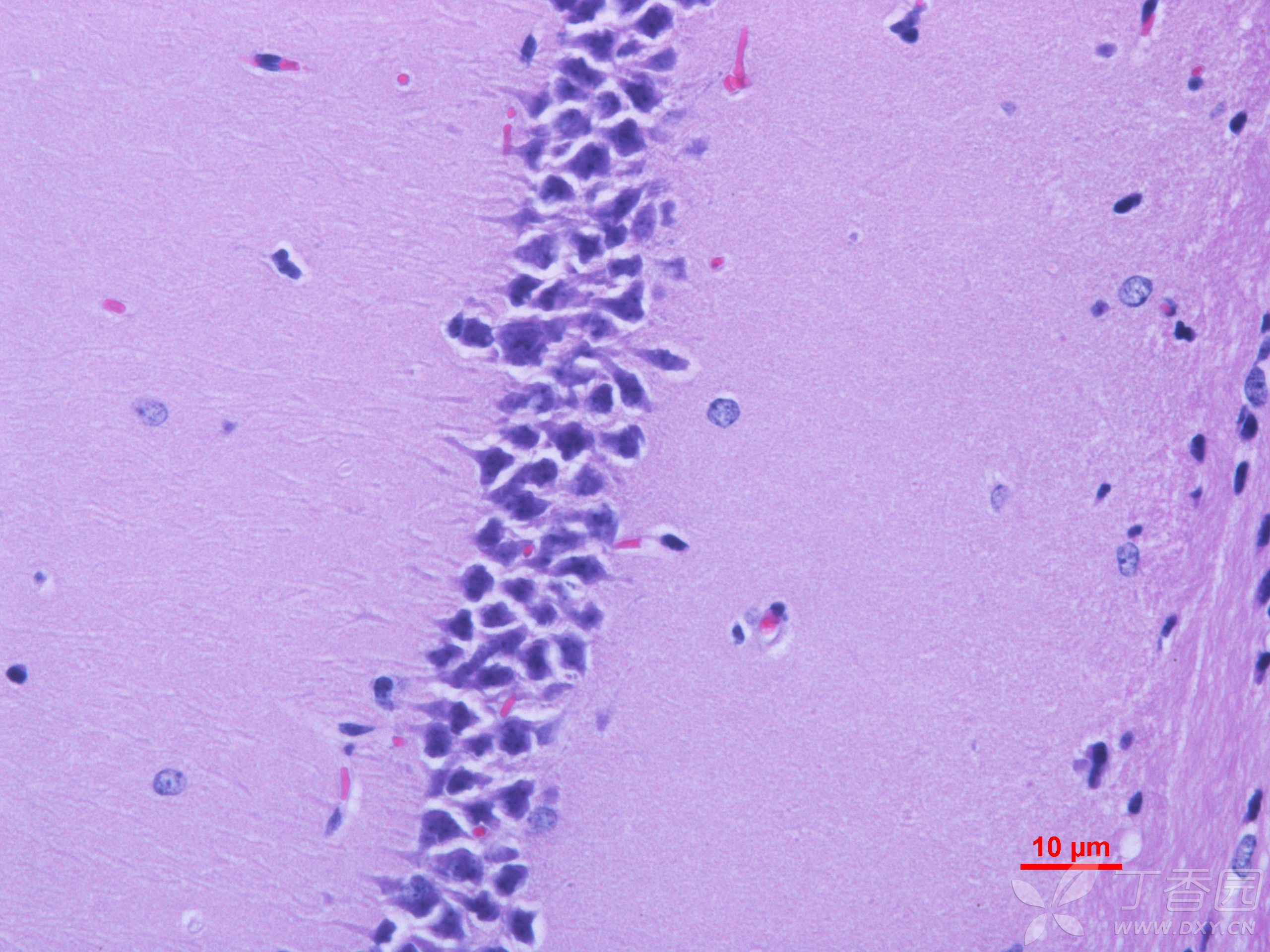 小鼠脑组织海马体染色切片问题 求解 形态学与生理生化讨论版-丁