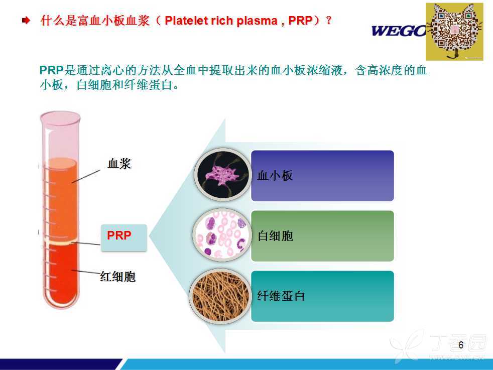 前沿技术-富血小板血浆prp的制备和运用详解