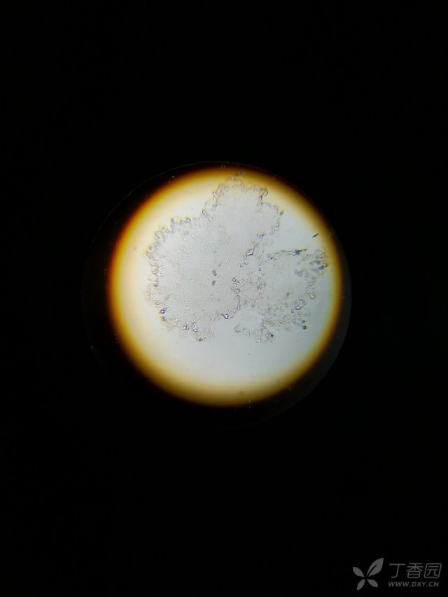 观察脚气真菌 显微镜倍数要多大