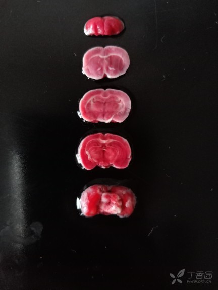 ttc染色(大鼠脑)之后为什么两面不一样,一面偏白色,一面红色.