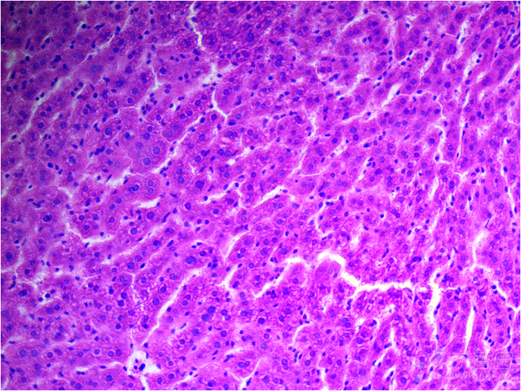 寻求哪位高手懂病理,帮忙分析下这两张小鼠的肝脏的he
