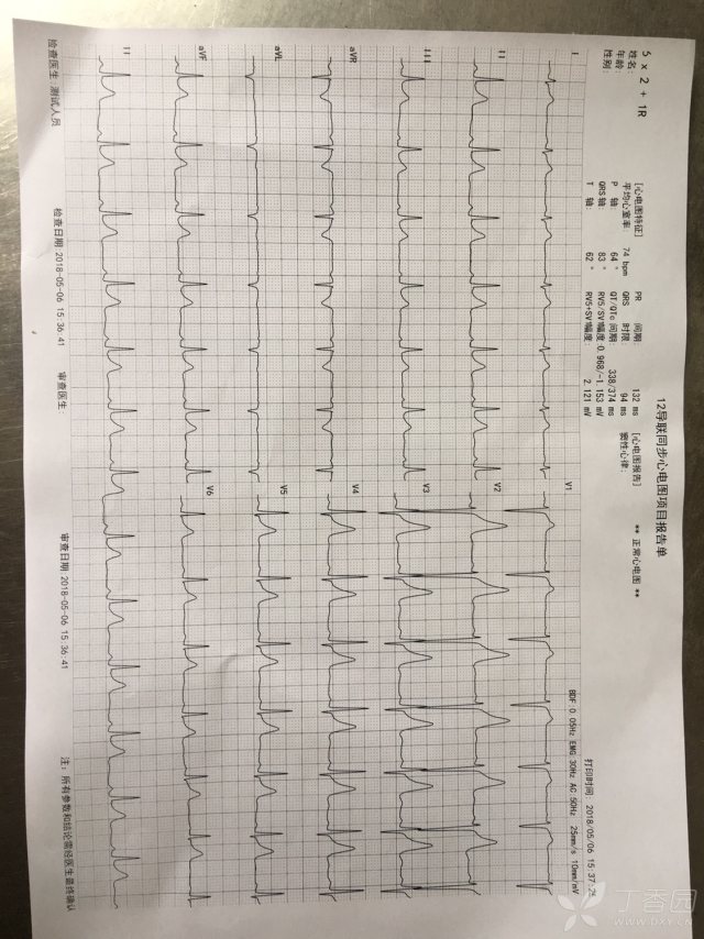 求大神看下心电图