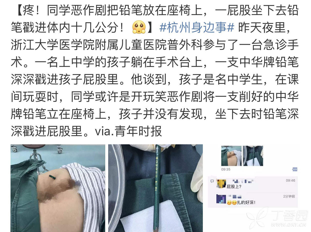 一根铅笔全扎屁股里了,熊孩子导致的意外伤.