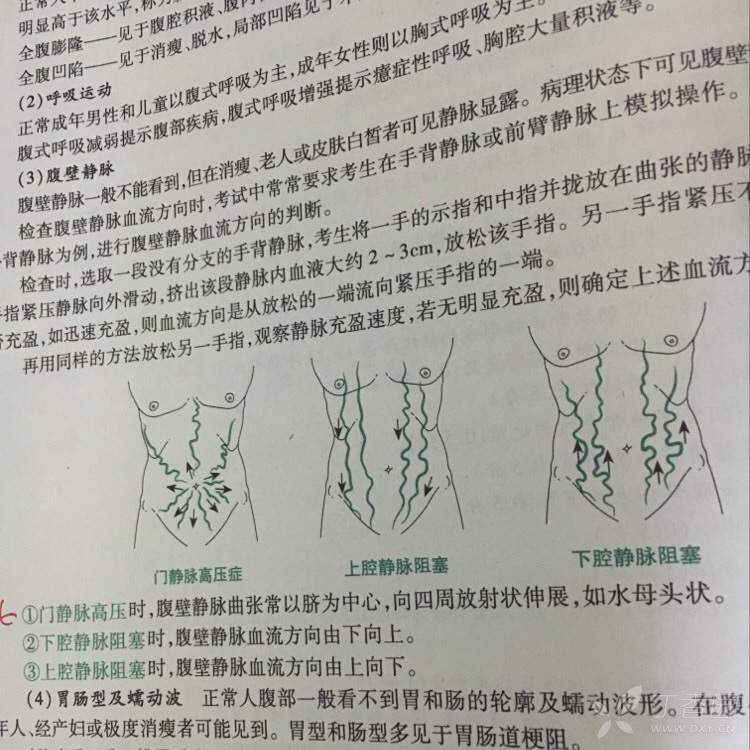 考考你的基本功:腹壁静脉曲张患者,脐以上血流方向由下至上,脐以下
