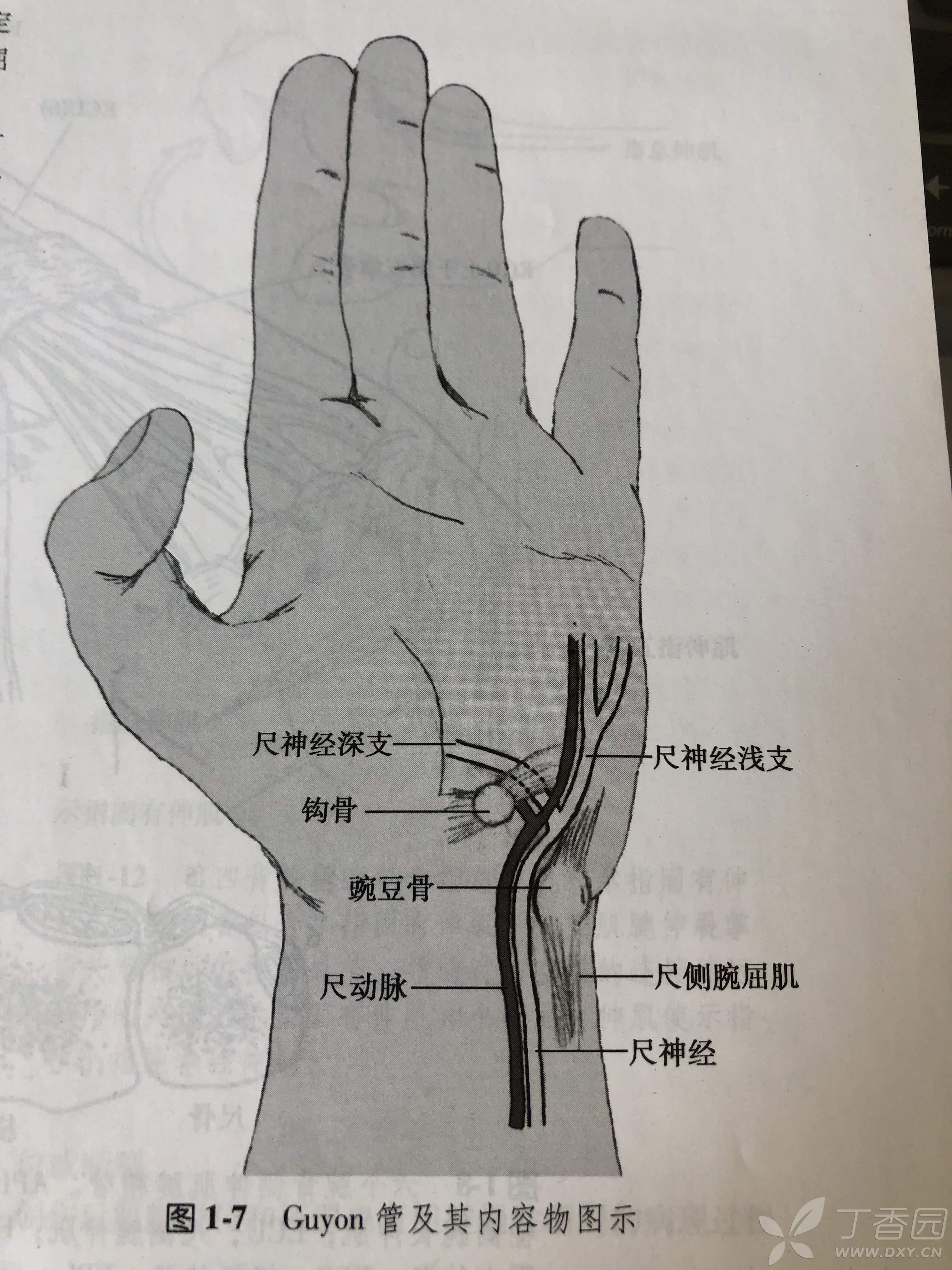 看图学手外科基础知识之1:腕尺管综合征