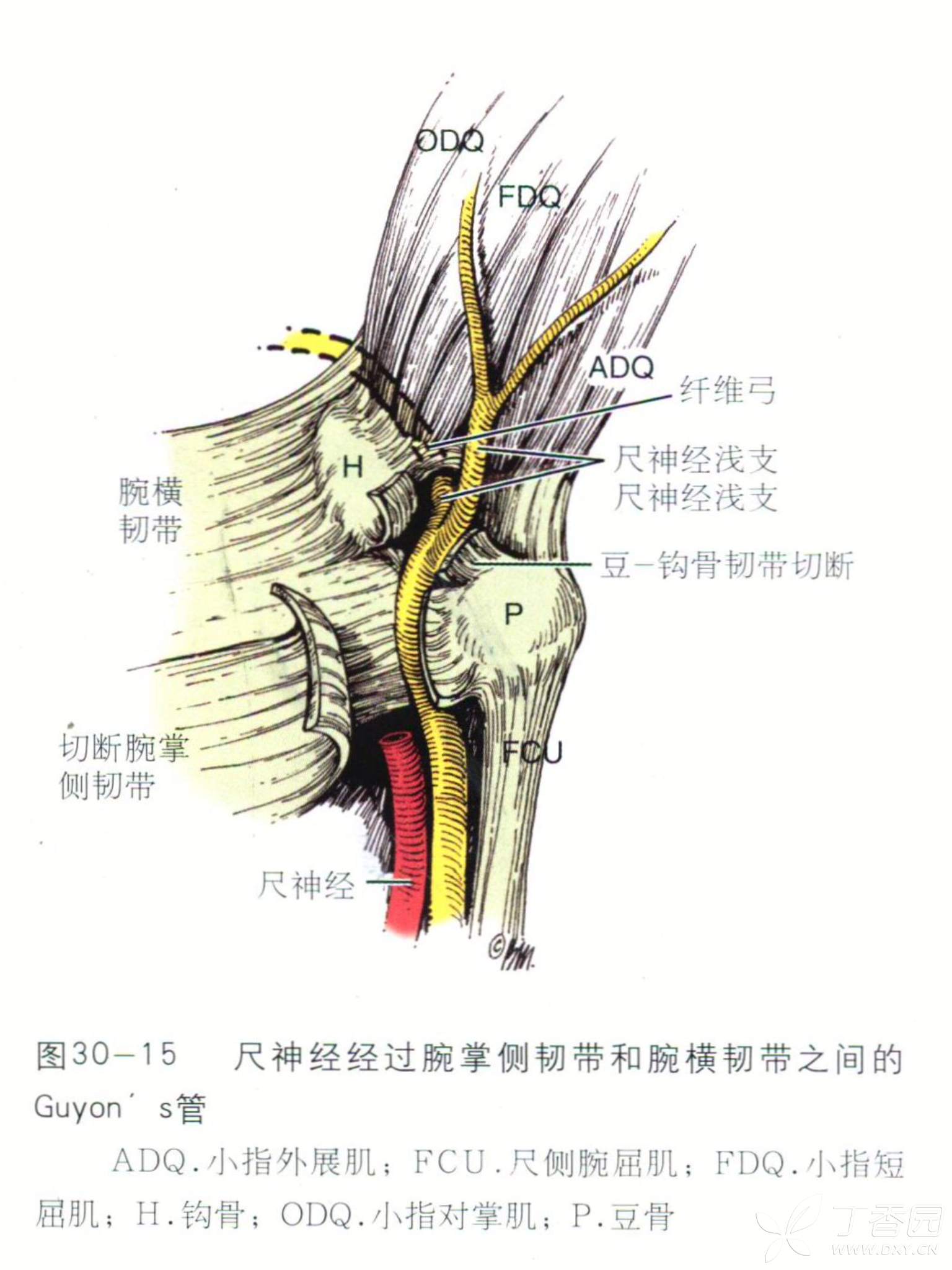 看图学手外科基础知识之1:腕尺管综合征