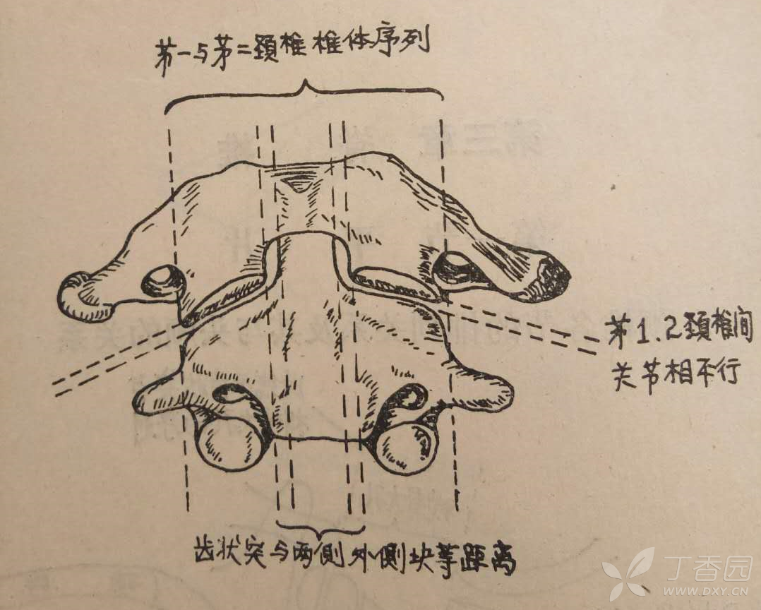 (2)齿状突与环椎侧块的关系异常:张口位或体层片上一侧间隙增宽>4mm为