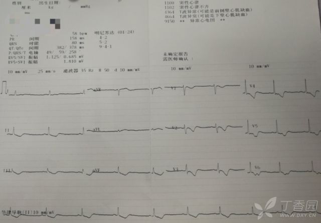 怒吞300 片地高辛!看看全程心电图演变