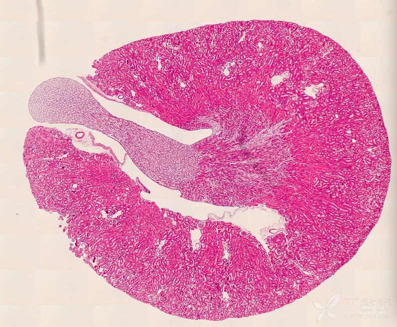肾脏结构识别|下图为小鼠肾脏横切面he染色片子,请问图中黄圈内的结构