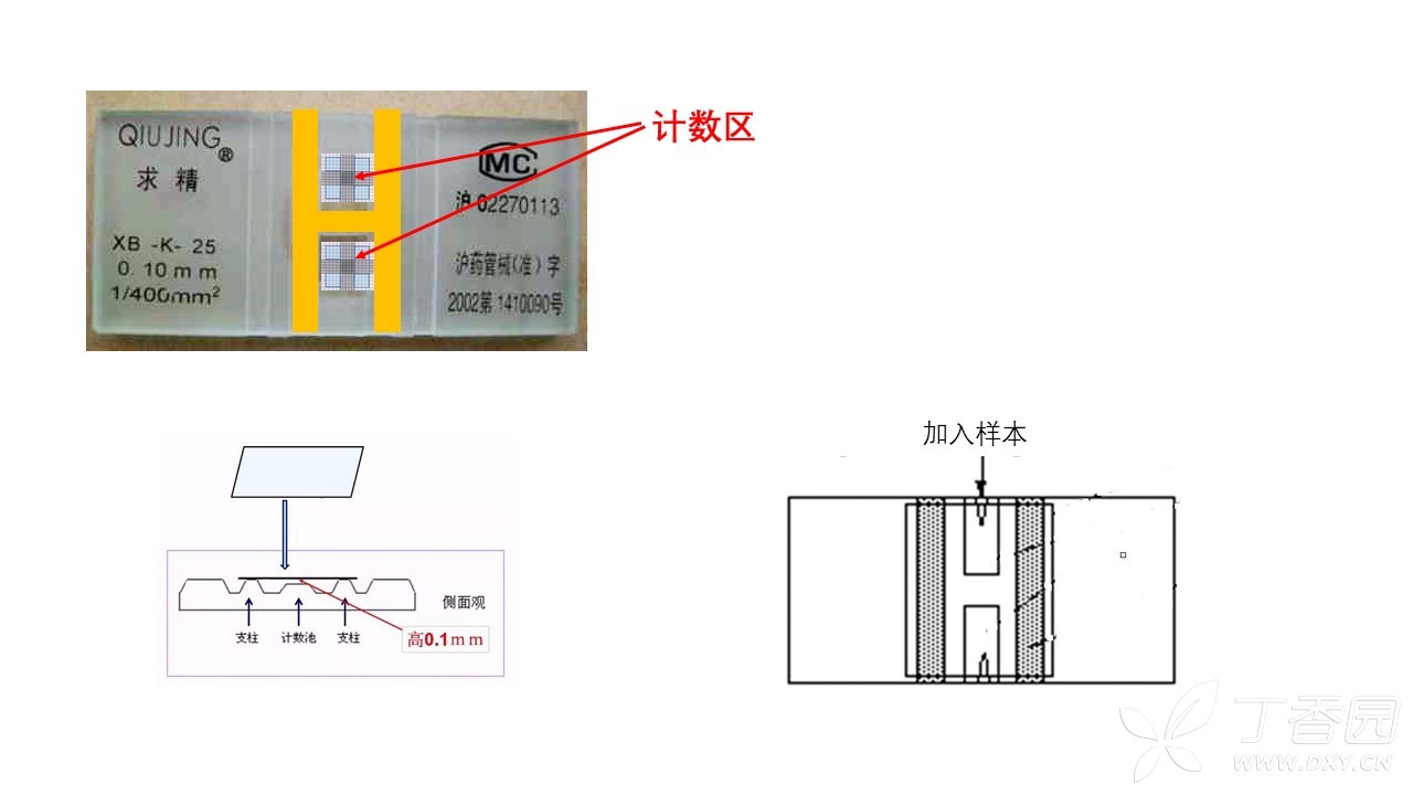 牛鲍计数板的使用和考级相关真题