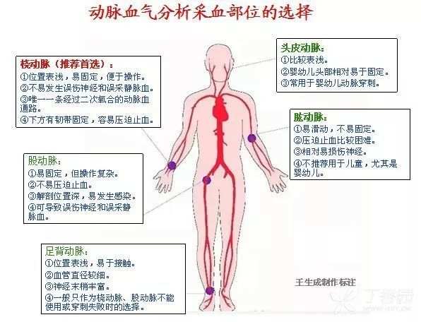 因桡动脉位置表浅而易触及,且无静脉与之毗邻,可避免误入静脉而大大