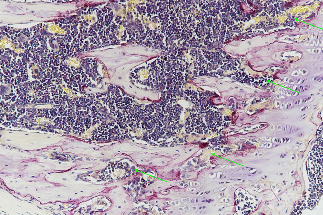 【求助】骨组织切片中,请高手帮忙确认不同种类的骨髓细胞