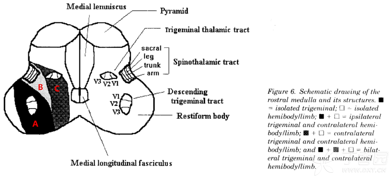 is located posteriorly to the ascending spinothalamic tract,and