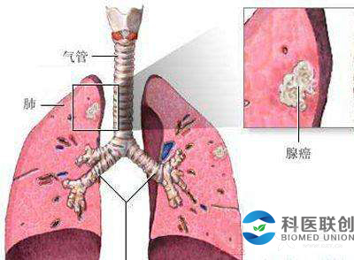 年11月27附加险是主险的补充和延伸,虽然名为附加,但其作用也不可小视