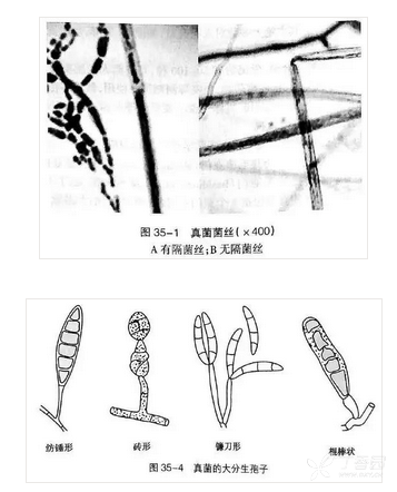 例如,新型隐球菌的菌落. 类酵母型菌落(单细胞真菌):孢子+假菌丝.