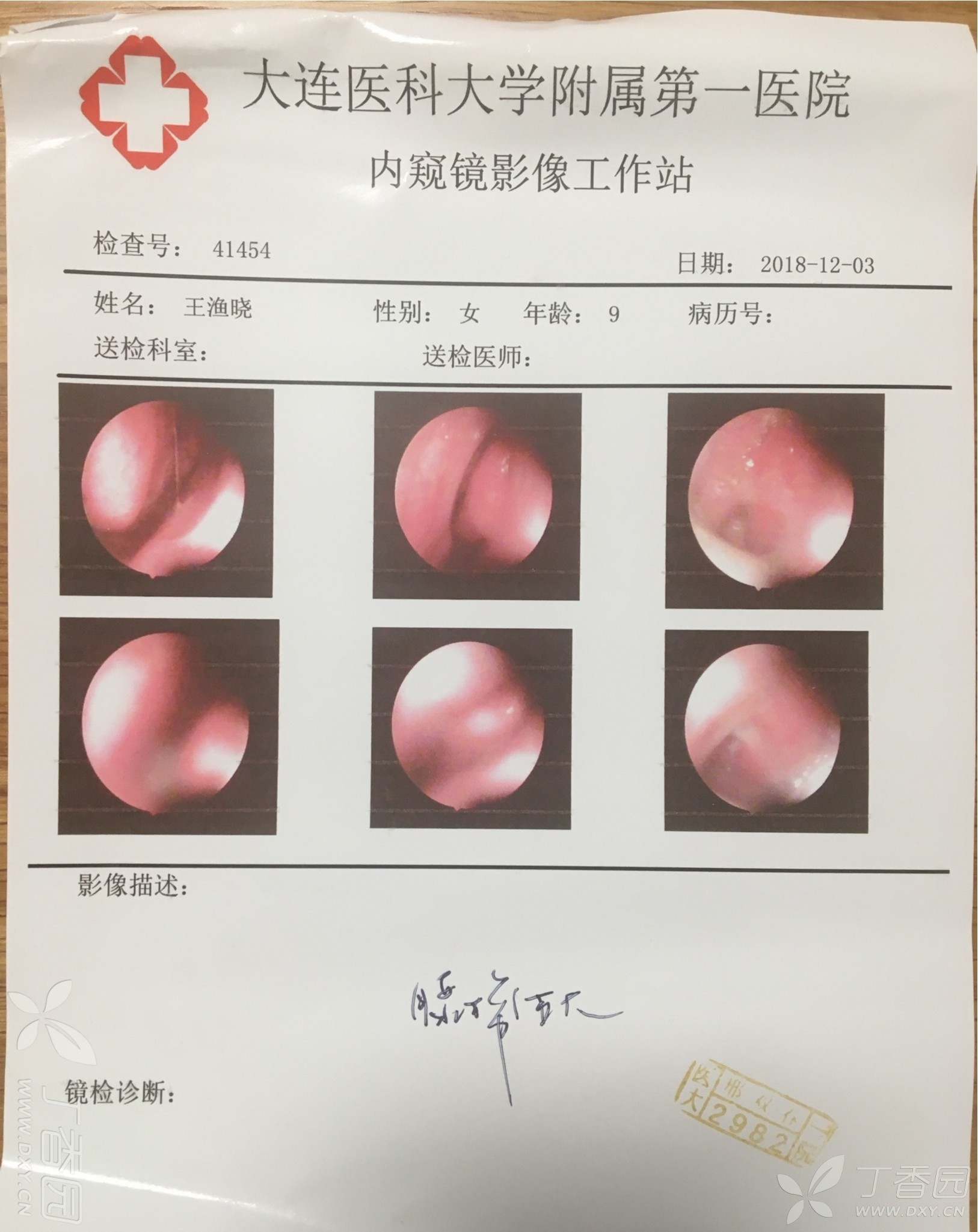 大夫可能比较忙,也没说腺样体肥大到什么程度,片子也没有结论,又回去