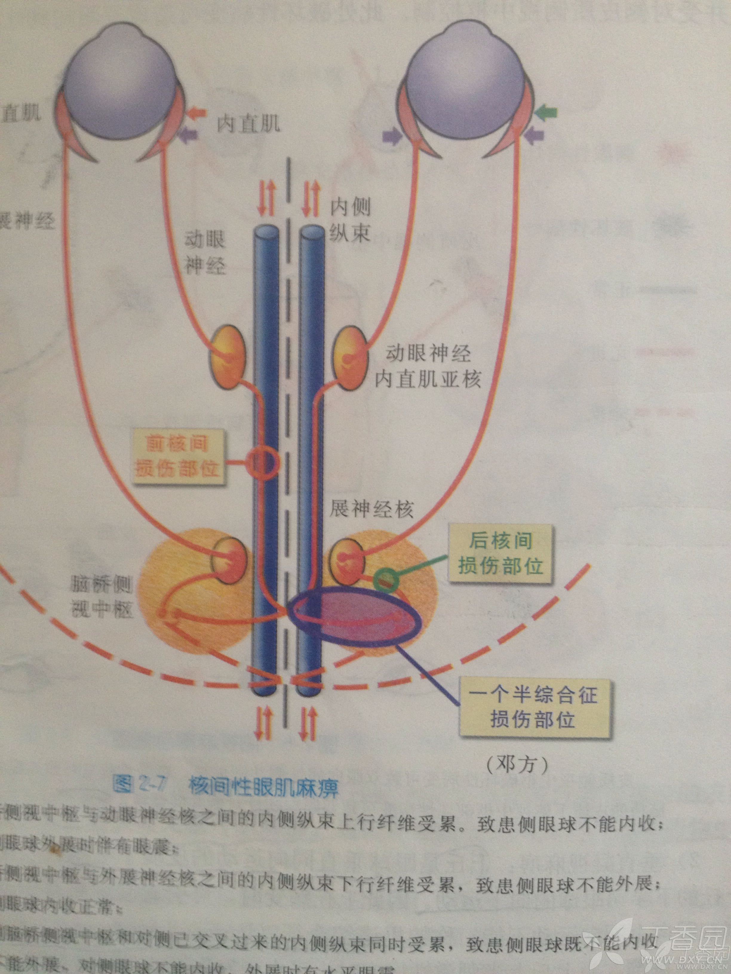 脑桥侧视中枢