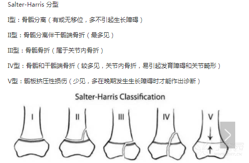 影像医学和核医学讨论版 普放Ⅰ型:骨折线仅穿过骺板软骨,骺分离