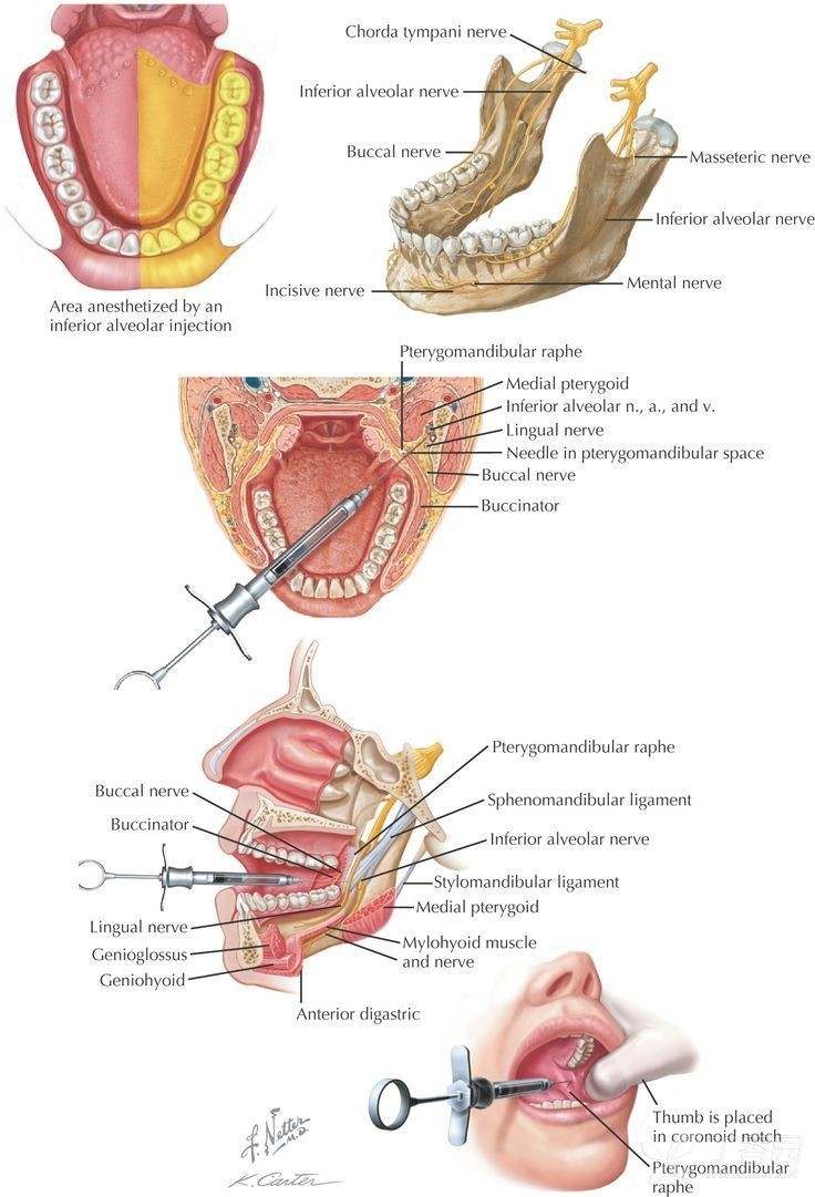 下牙槽神经阻滞麻醉ppt