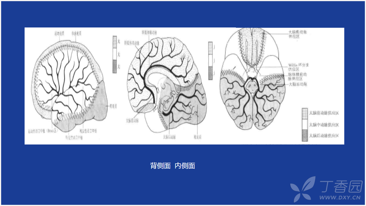 脑分水分水岭梗死 ppt学习分享