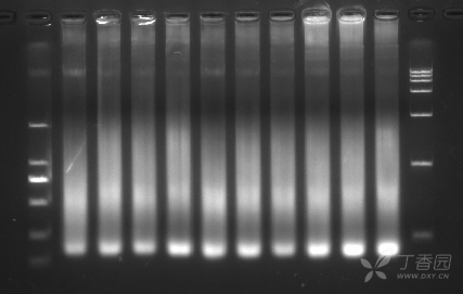 rna的琼脂糖凝胶电泳