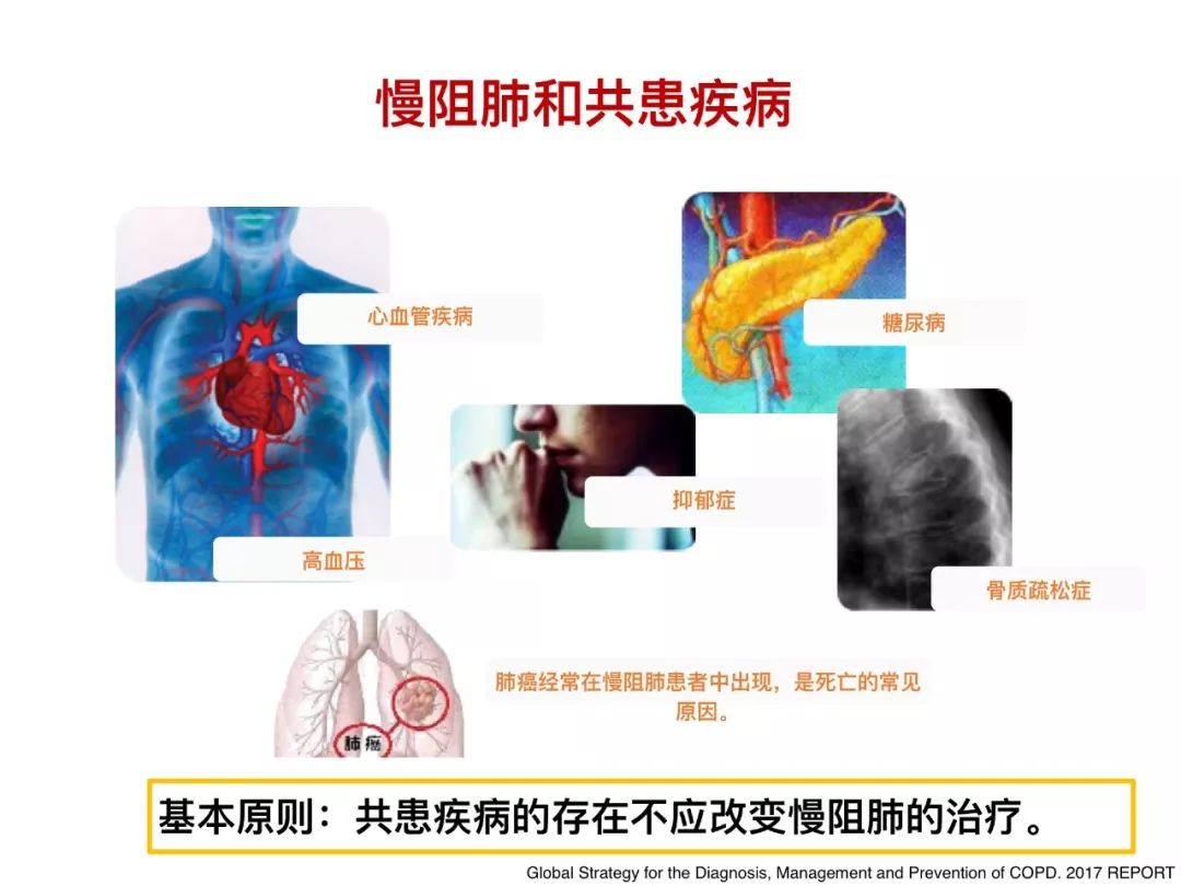 社区慢阻肺管理之三:治疗与预防