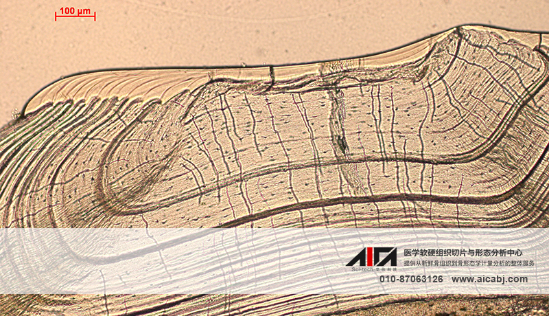 硬组织切片骨磨片骨形态计量分析特殊染色