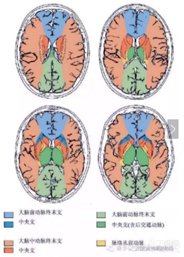 基底节包括内囊外囊吗?内囊,外囊是囊性的吗?