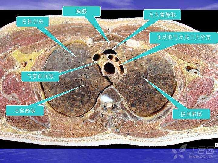 肺和胸膜的横断层解剖ppt